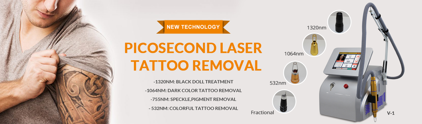 remoção de tatuagem a laser de picossegundo