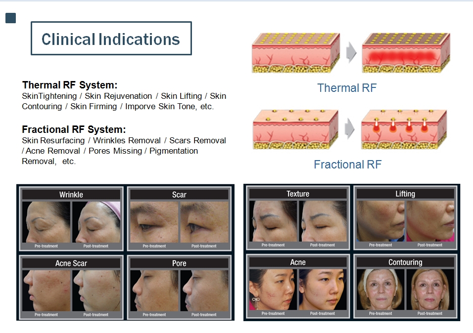 indicações clínicas