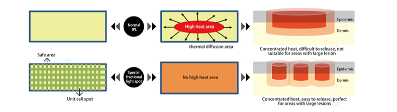 Skin Rejuvenation Machine Máquina de rejuvenescimento da pele