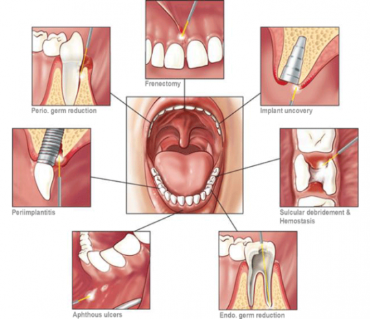 dental