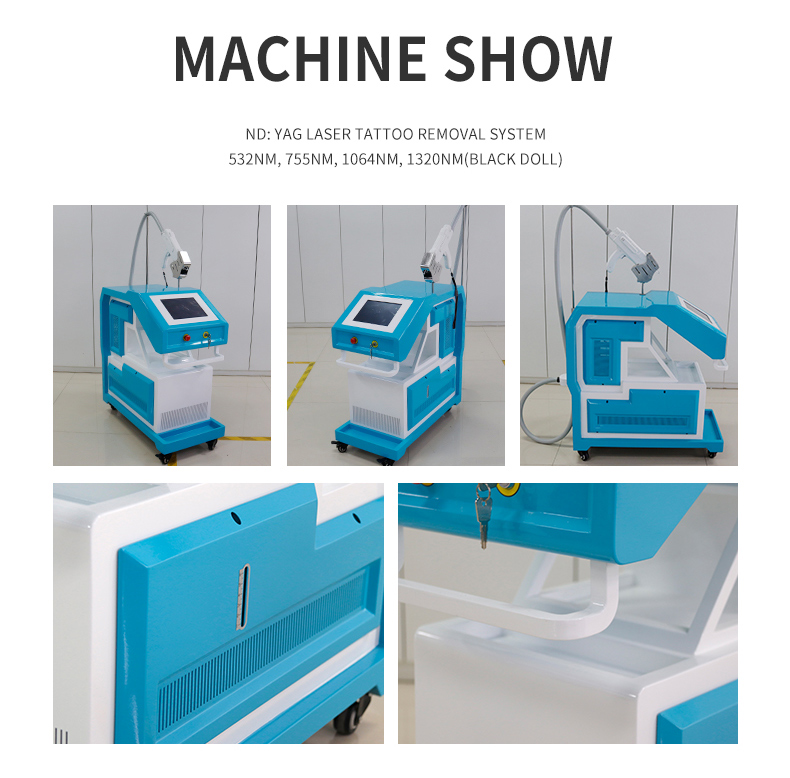 M&aacute;quina de remo&ccedil;&atilde;o de tatuagem