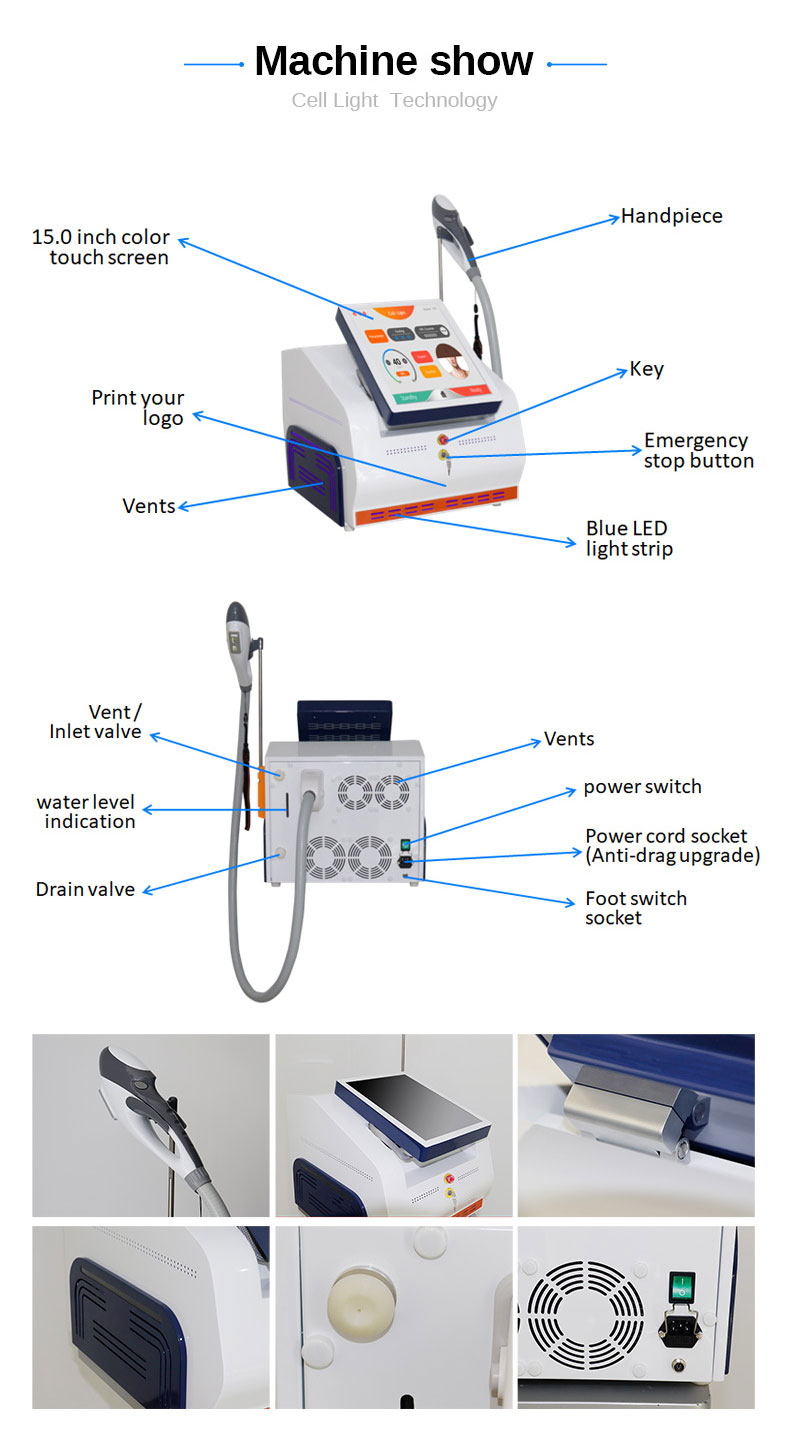 Remo&ccedil;&atilde;o de cabelo leve de c&eacute;lula 