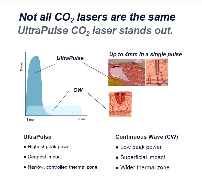 Recapeamento da pele