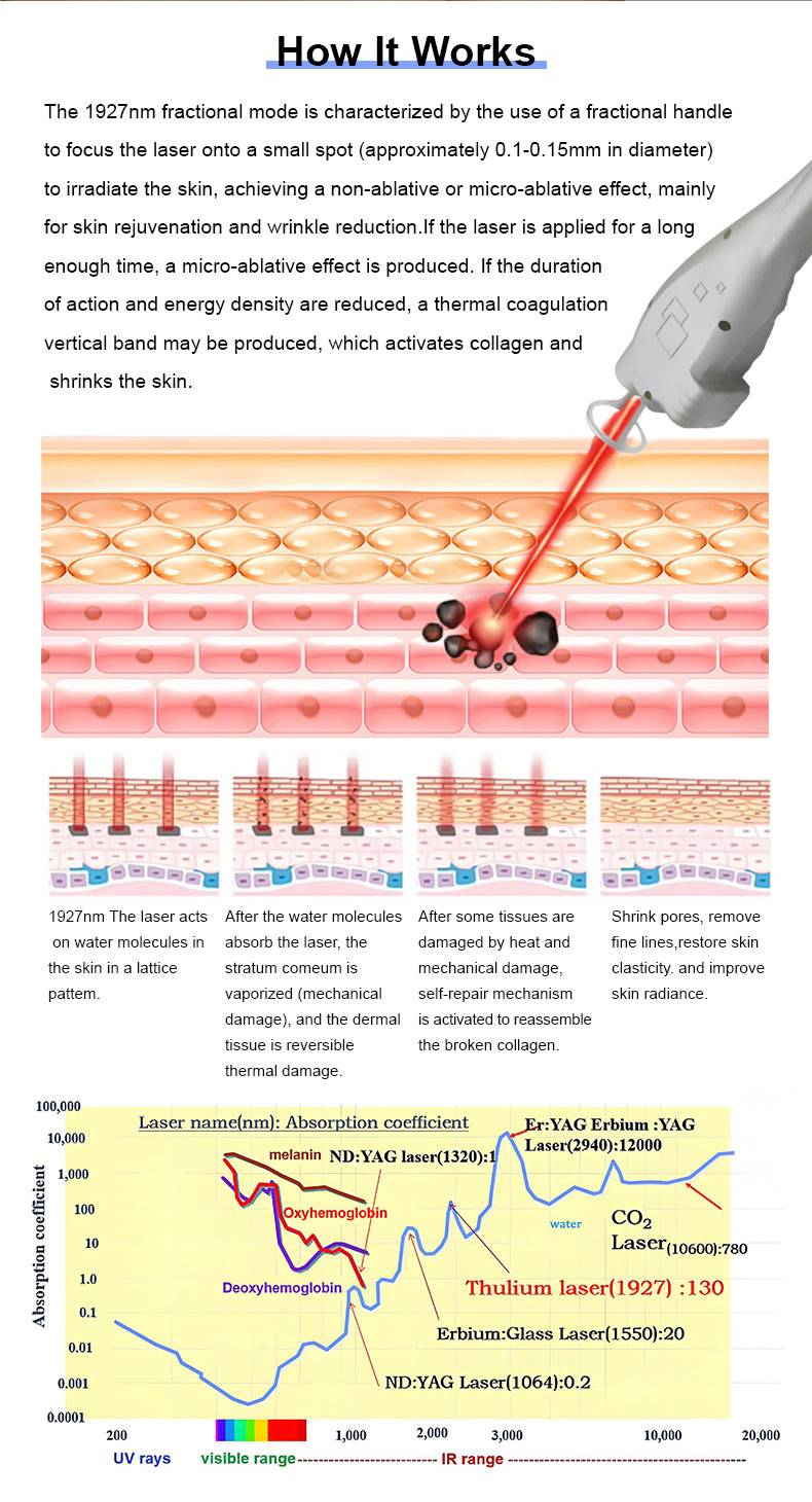 1927nm thulium laser fracion&aacute;rio 