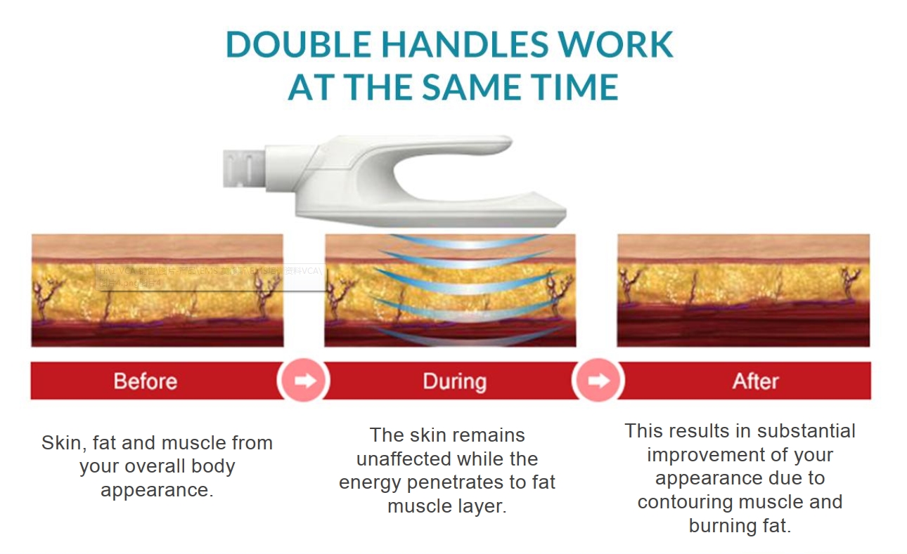 AL&Ccedil;AS EMSCULPT