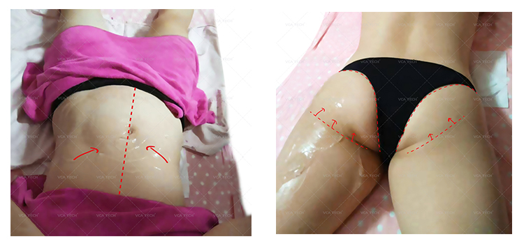 M&aacute;quina Hifu Modelo 3D