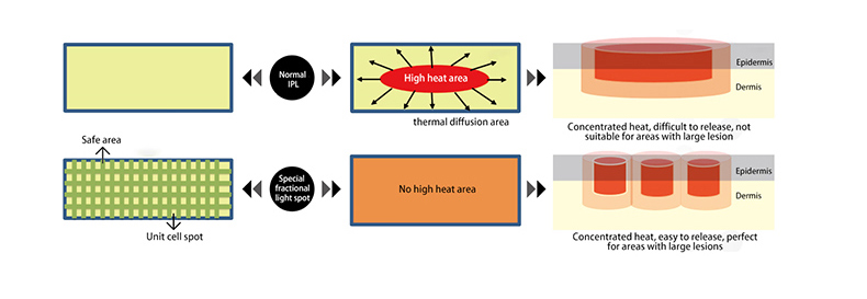 M&aacute;quina de rejuvenescimento profissional da pele