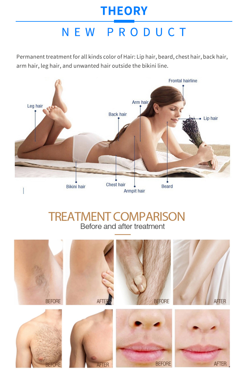 m&aacute;quina de depila&ccedil;&atilde;o a laser