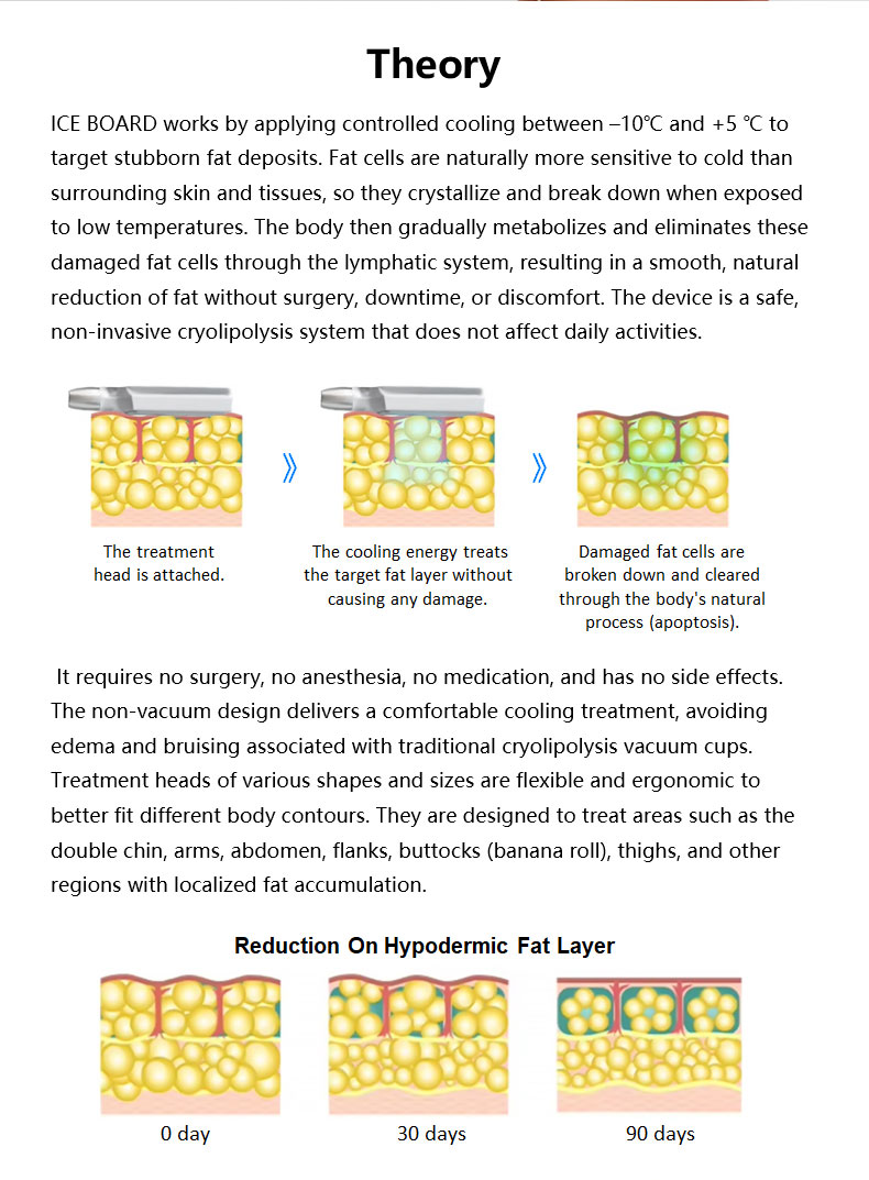 M&aacute;quina de emagrecimento de placa congelada 