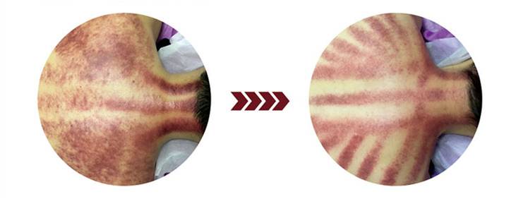 m&aacute;quina de v&aacute;cuo de cavita&ccedil;&atilde;o