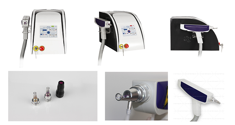 Remo&ccedil;&atilde;o de tatuagem a laser YAG