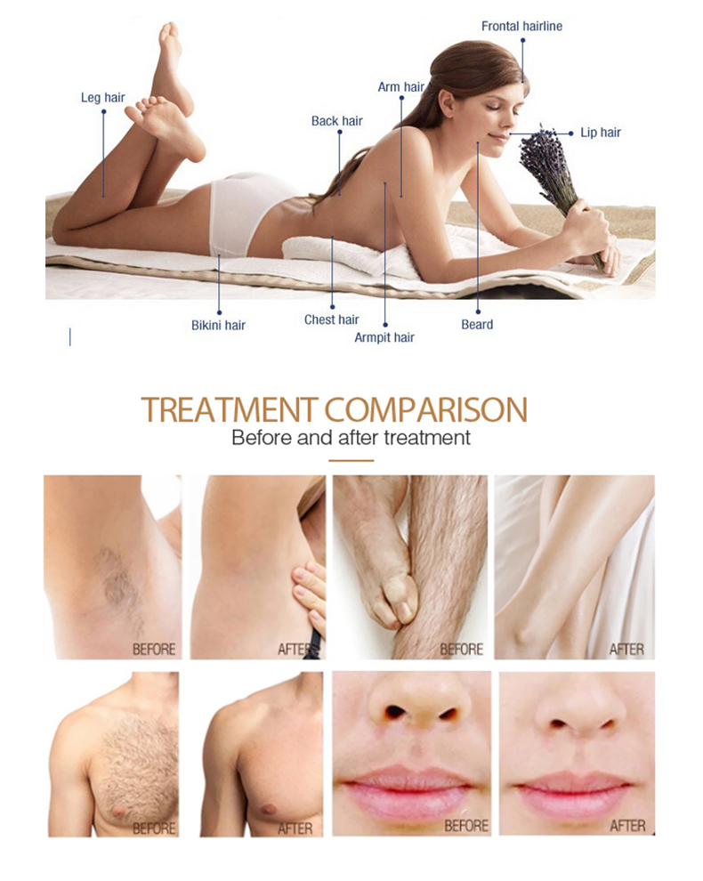 m&aacute;quina de depila&ccedil;&atilde;o