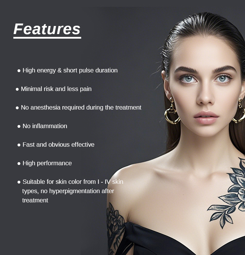 Remo&ccedil;&atilde;o de tatuagem a laser