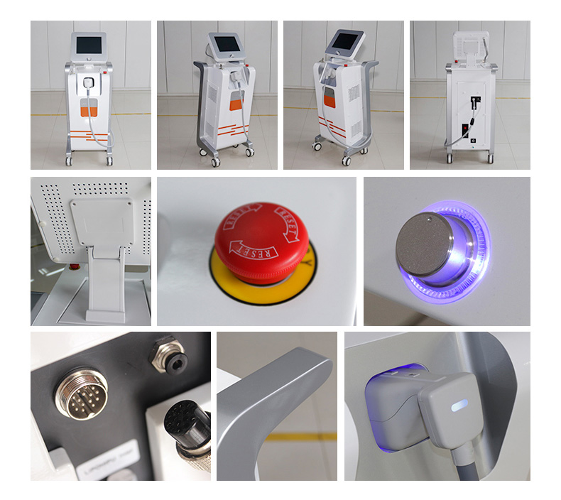 M&aacute;quina de emagrecimento corporal Hifu Liposonix