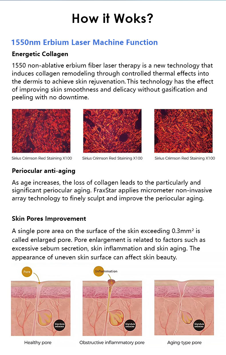 Tonifica&ccedil;&atilde;o da pele