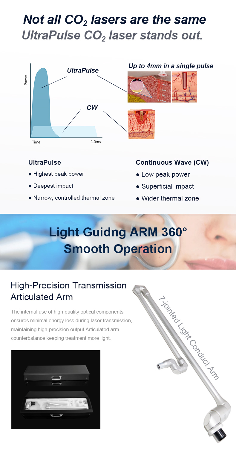 Laser fracion&aacute;rio de CO2