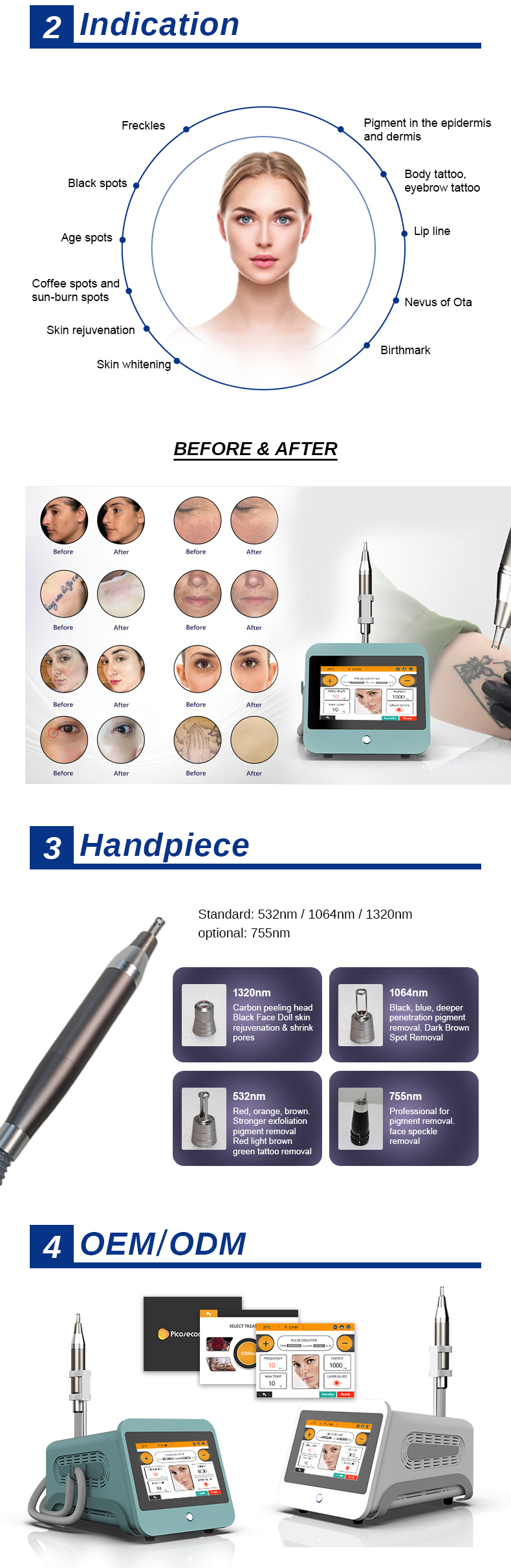 M&aacute;quina de remo&ccedil;&atilde;o de tatuagem