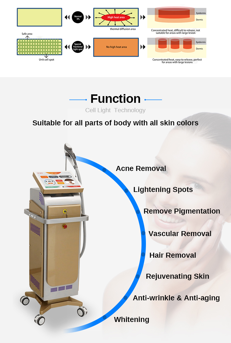 M&aacute;quina de remo&ccedil;&atilde;o de rugas