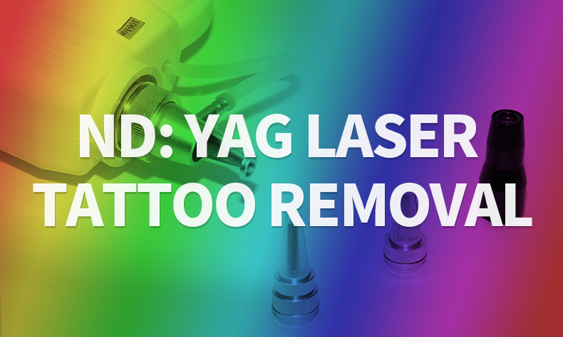 Melhor m&aacute;quina a laser para remo&ccedil;&atilde;o de tatuagem