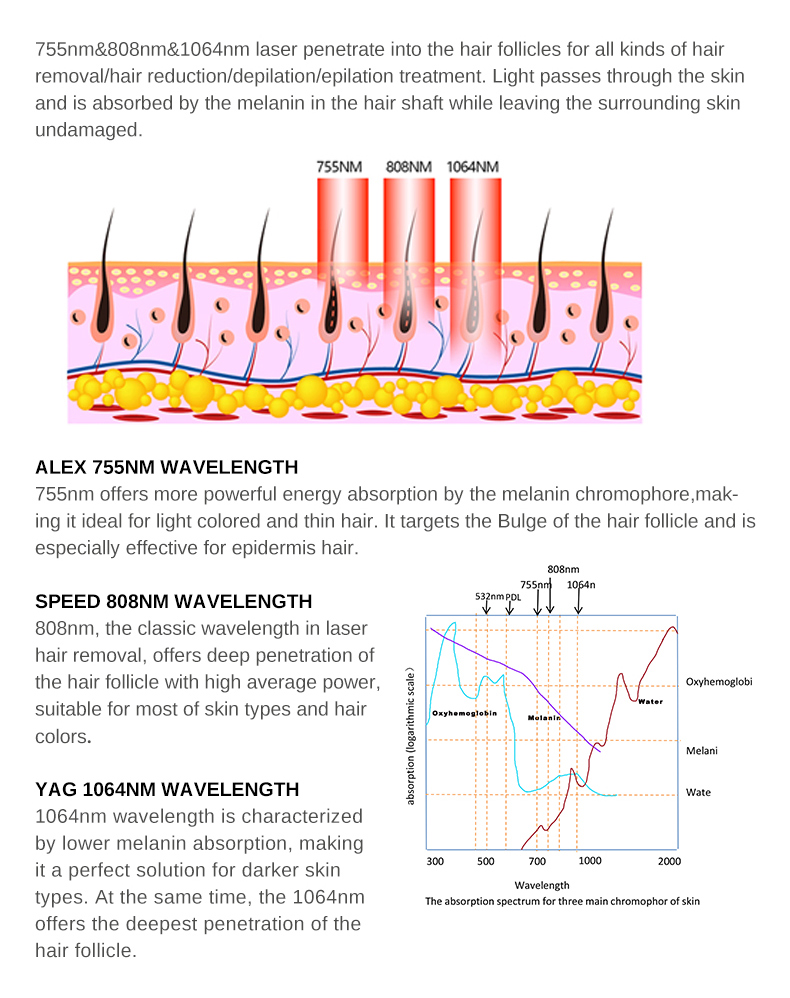 depila&ccedil;&atilde;o a laser
