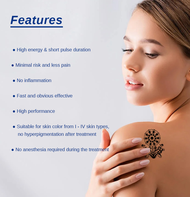 M&aacute;quina de remo&ccedil;&atilde;o de tatuagem