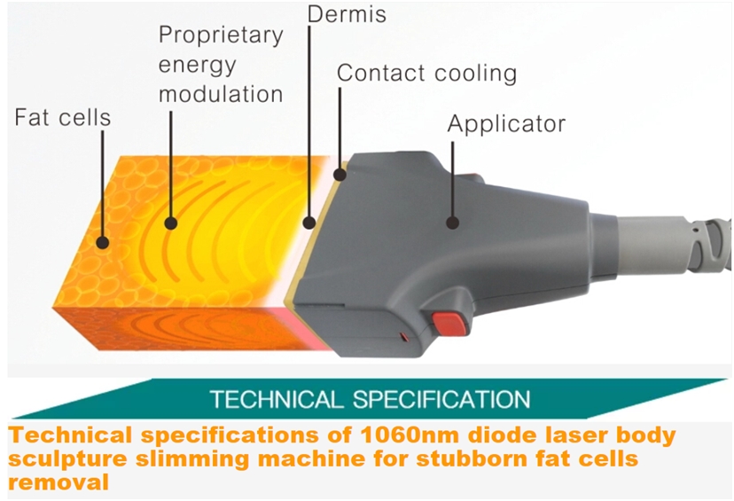 Laser de diodo SculpSure 1060nm contorno corporal