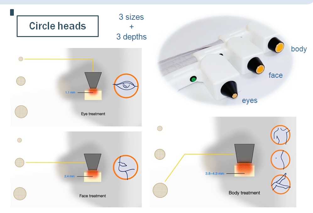3 cabe&ccedil;as circulares