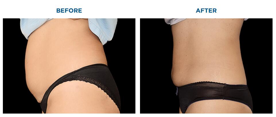 M&aacute;quina de perda de peso