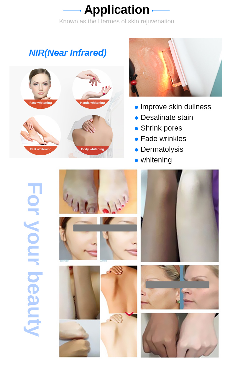 Melhor m&aacute;quina de clareamento eficaz 