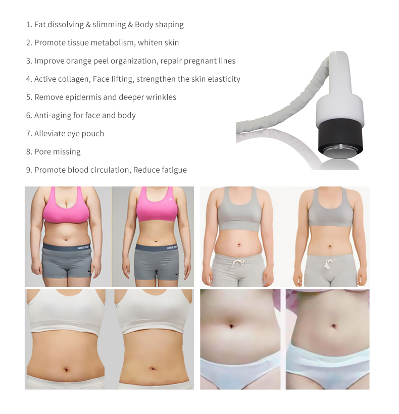 m&aacute;quina de emagrecimento