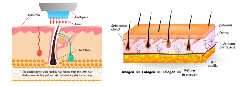 Remo&ccedil;&atilde;o de cabelo a laser 