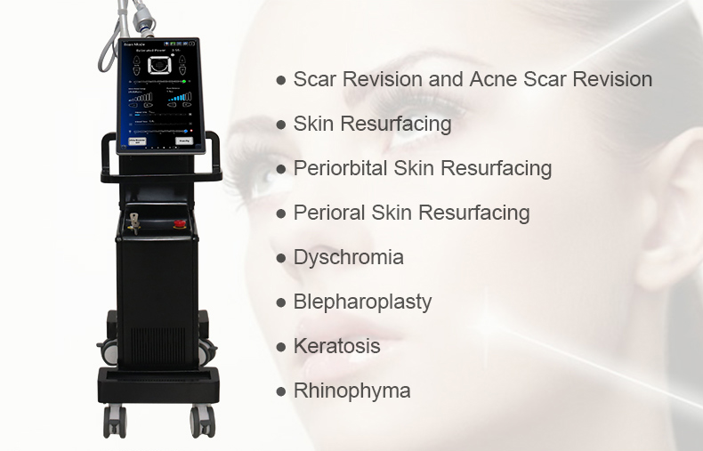 Laser fracion&aacute;rio de CO2