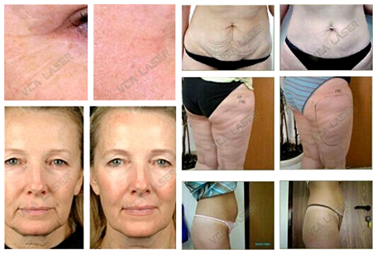 fun&ccedil;&atilde;o de RF