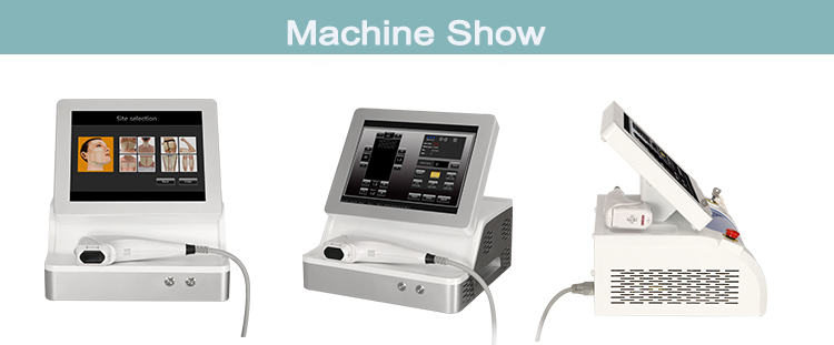 M&aacute;quina Hifu Modelo 3D