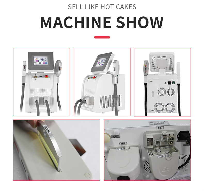 OPT IPL M&aacute;quina de remo&ccedil;&atilde;o de p&ecirc;los