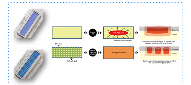2. Duas formas de sa&iacute;da de densidade, ponto de favo de mel e ponto de luz fracion&aacute;ria especular, tecnologia de transmiss&atilde;o instant&acirc;nea de favo de mel, melhorar a seguran&ccedil;a do tratamento cl&iacute;nico de grande &aacute;rea