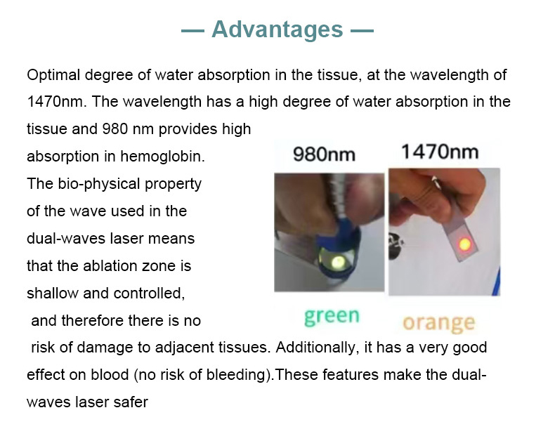 m&aacute;quina de lip&oacute;lise a laser de diodo