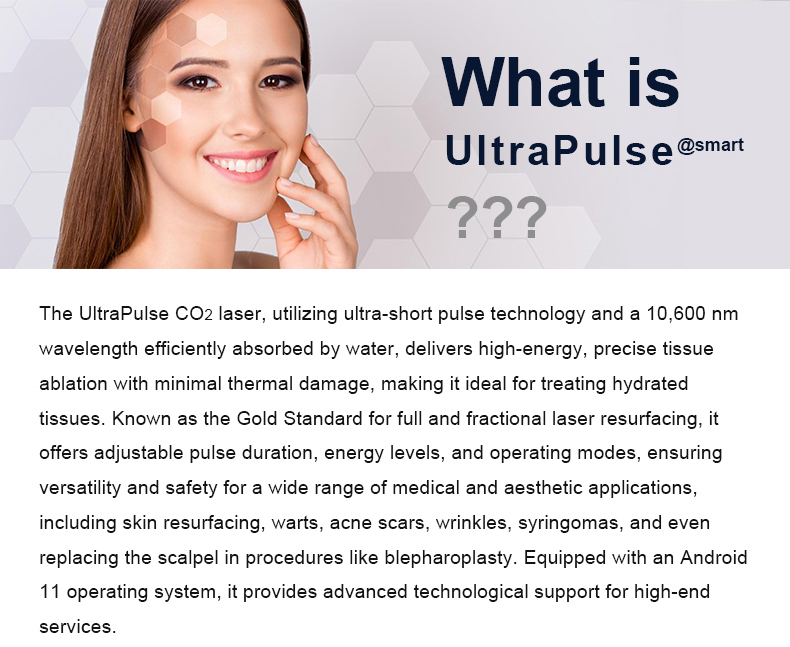 Laser fracion&aacute;rio de CO2