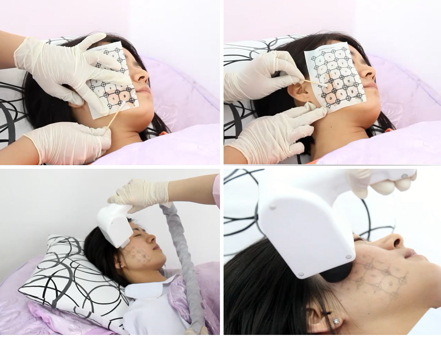 tratamento cl&iacute;nico termage