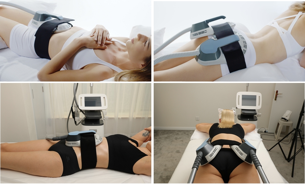 tratamento cl&iacute;nico para EMS