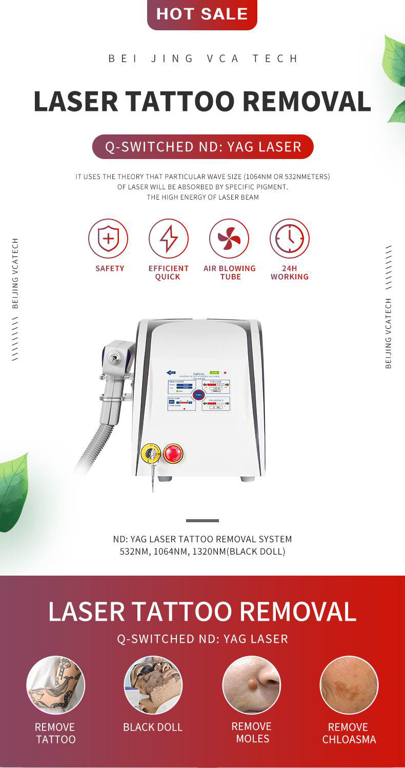 Remo&ccedil;&atilde;o de tatuagem a laser