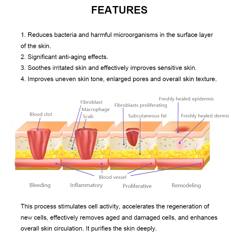 M&aacute;quina de plasma frio