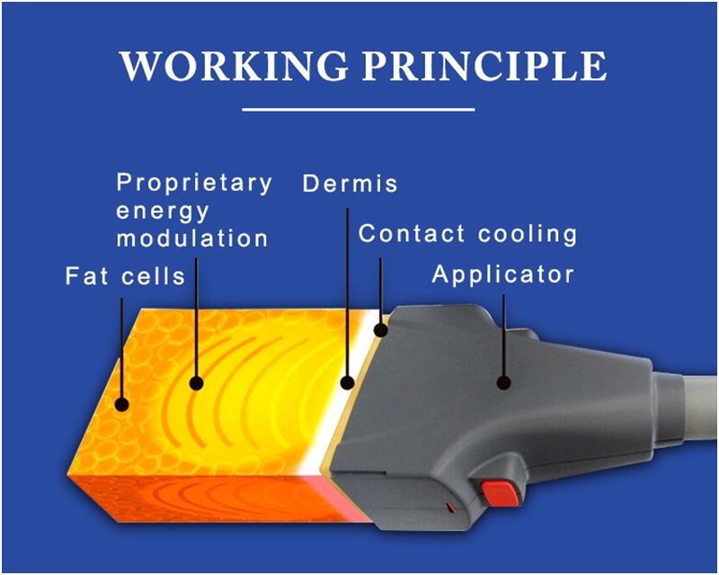 Laser Sculp 1060nm para contorno corporal e emagrecimento corporal
