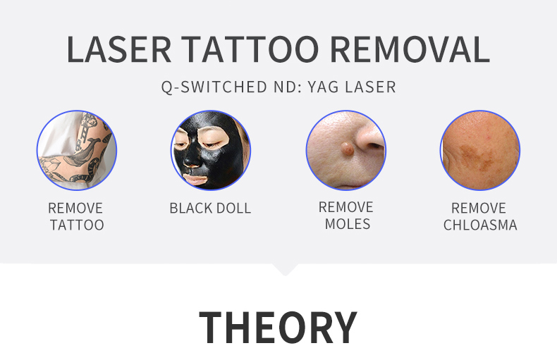 M&aacute;quina de remo&ccedil;&atilde;o de tatuagem