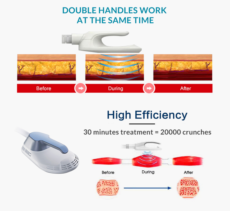 M&aacute;quina de escultura corporal EMS