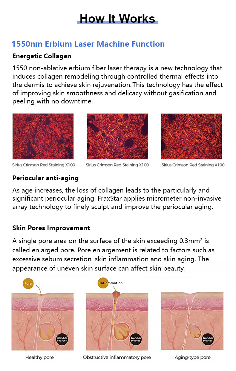 Laser de vidro de erbio