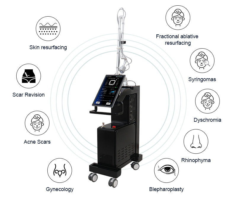 Laser fracion&aacute;rio de CO2