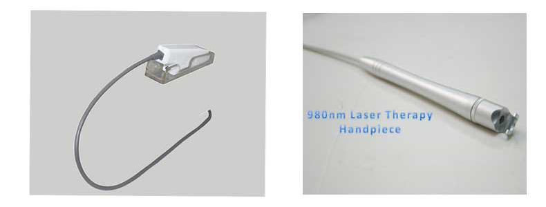 Remo&ccedil;&atilde;o da veia da aranha