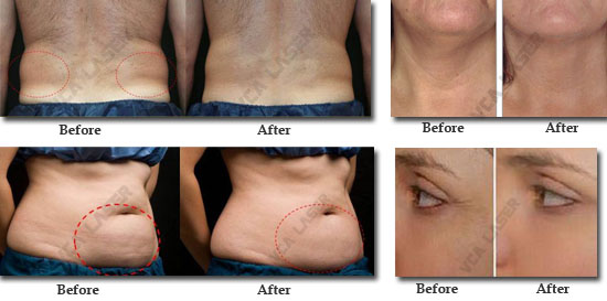 tratamento-MARK550(6)