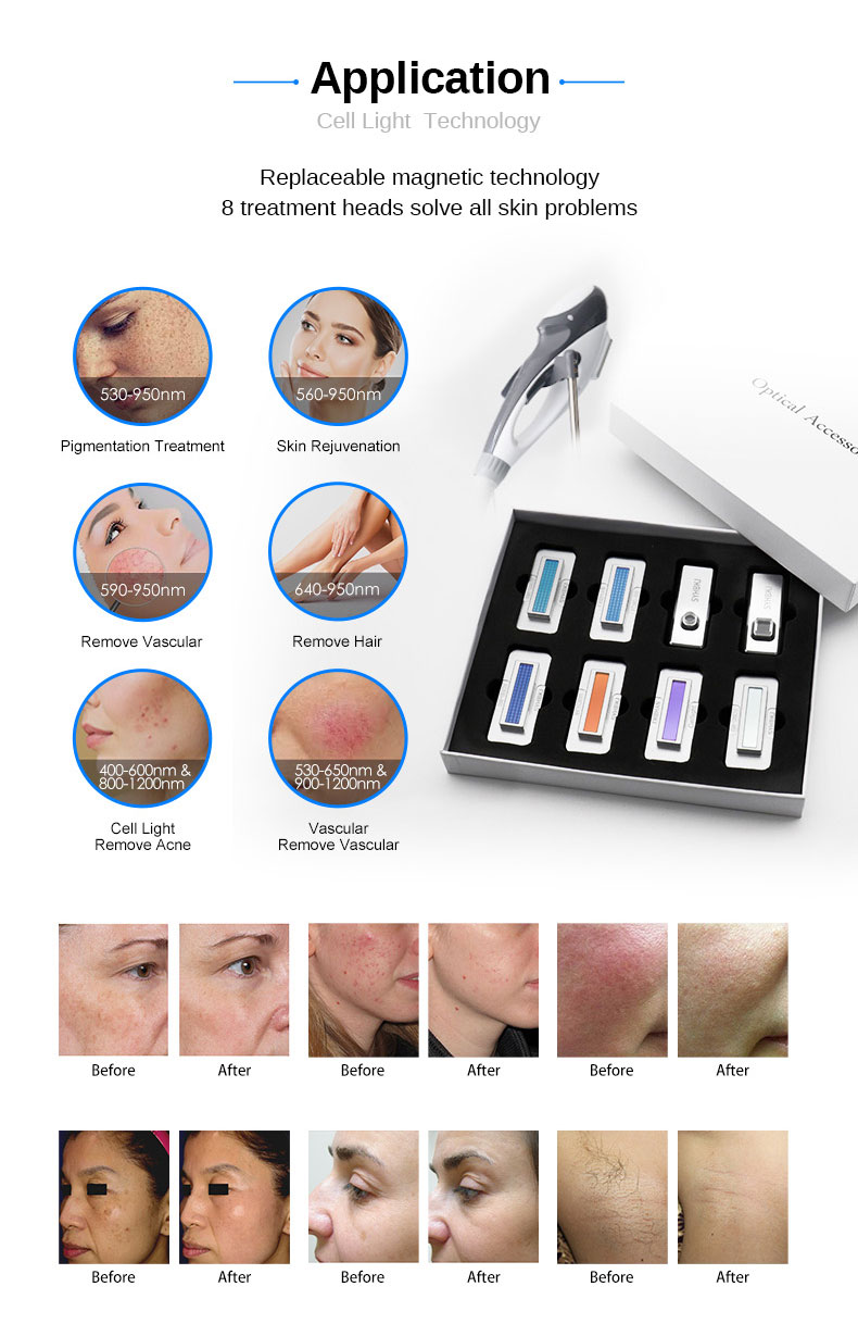 Eqipment rejuvenescimento da pele